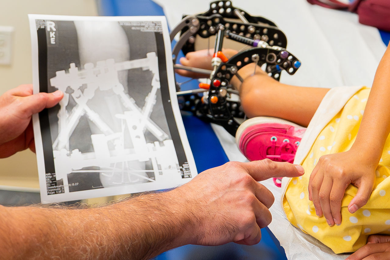 Limb correction X-ray and patients leg