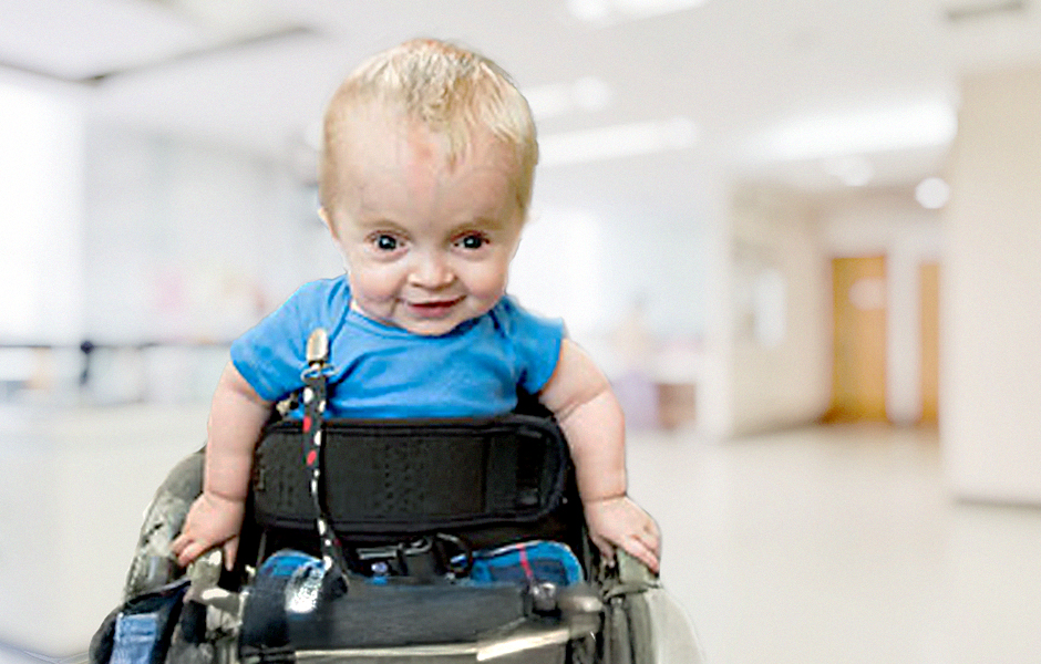 Isaiaha, un niño con osteogénesis imperfecta